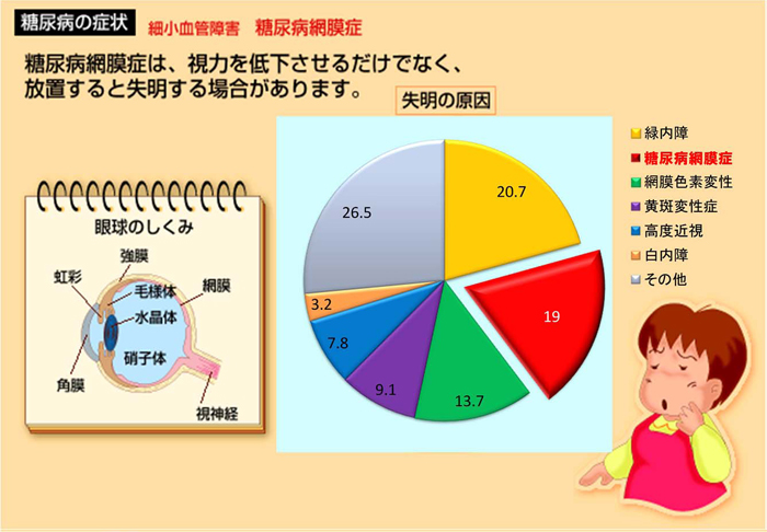 細小血管障害　糖尿病網膜症　糖尿病網膜症は視力を低下させるだけでなく、放置すると失明する場合があります。